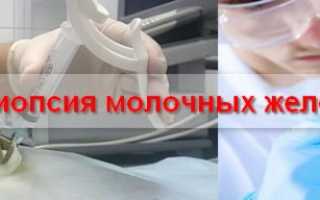 Биопсия аспирационная биопсия молочной железы – Сайт о диагностике заболеваний
