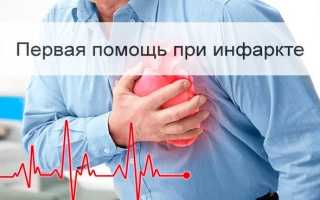 Первая помощь при инфаркте миокарда: признаки и особенности лечения