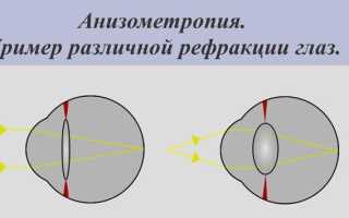 Разное зрение на глазах — причины, диагностика и особенности лечения